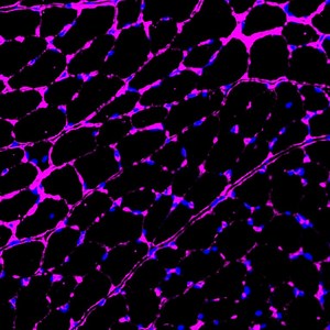 Salk scientists modify CRISPR to epigenetically treat diabetes, kidney disease, muscular dystrophy – Lifeboat News: The Blog