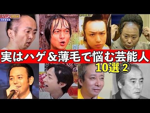 実はハゲ＆薄毛で悩む芸能人10選②衝撃の10人とは…まさかのイケメン俳優やアイドルまで…