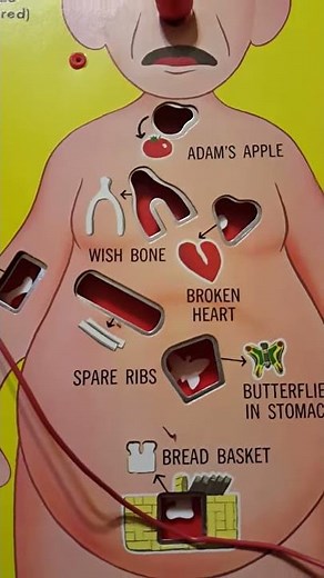 Vintage 1960's Operation game, Working, FOR SALE