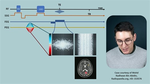 9 Phase Encoding Gradient MRI