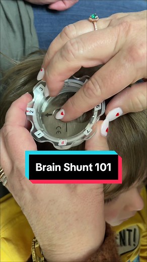Brain Shunt 101 🧠 #hydrocephlus #hydrocephalusawareness #hydrowarrior #brainsurgery #shunt #brainshunt #brainsurgerysurvivor #survivor #inspiration #inspirational #toddler #learn #learnontiktok #neuro #neuroscience #neurosurgery #neurosurgeon #stem #fyp #fypシ