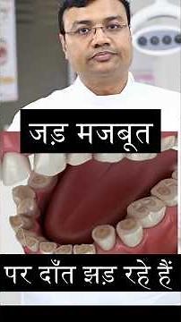 Yellow Teeth Are NOT Stains — This Is Dental Erosion! | DR. Kapil Gupta