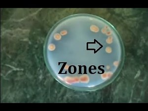 How to isolate phosphate solubilizing bacteria