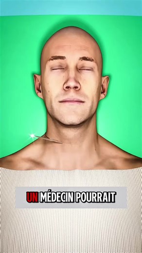 Chirurgie théorique de transplantation de tête