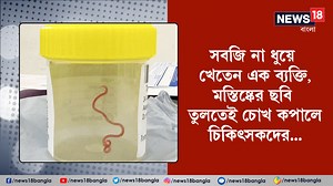 112K views · 779 reactions | Health Awarness: সবজি না ধুয়ে খেতেন এক ব্যক্তি, মস্তিষ্কের ছবি তুলতেই চোখ কপালে চিকিৎসকদের #healthawareness #lifestyle #news18banglaoriginalvideo | News18 Bangla | Facebook