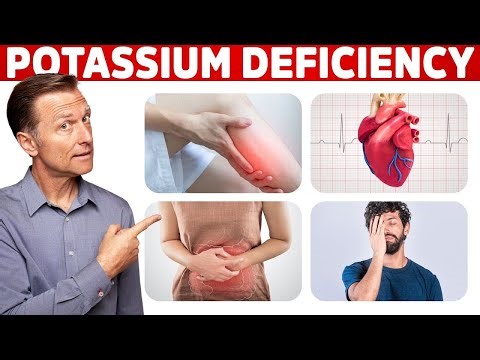Low Potassium: Signs, Symptoms, Causes, and Treatment | Dr. Eric Berg | Health Motivational Speech