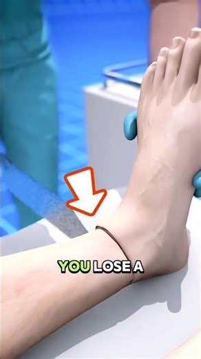 Lost a Leg but Still Feel It?