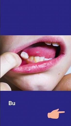 Can kids wiggle their loose tooth?