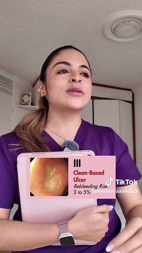 Clasificación de Forrest en Medicina Interna