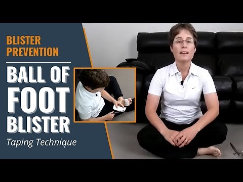 Ball Of Foot Blister Taping Technique | Blister Prevention