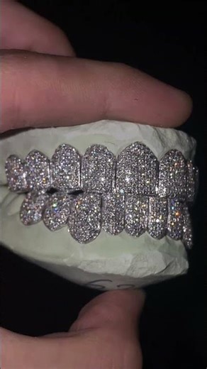 YELLOW OR WHITE? VVS LAB GROWN DIAMOND GRILLZ