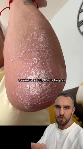 10K views | 70% OFF Healthy skin. BLACK FRIDAY OFFER. Experience the natural skincare sensation that’s got everyone talking  | NX1 project | Facebook