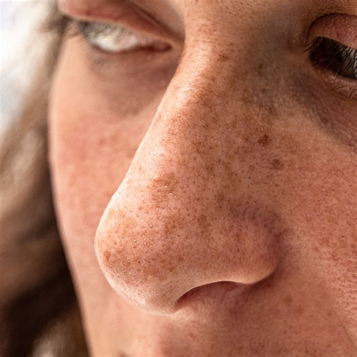 Derm Reveals Whether Sunscreen Can Help With Wrinkles And Anti-Aging