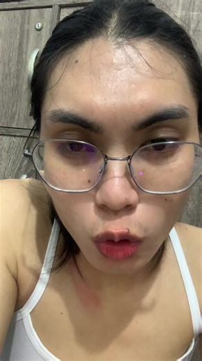 10 days on E 🏳️‍⚧️ #transgender #makeitviral #foryoupage