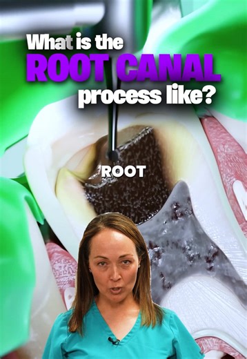 If you’re in need of a root canal make sure to reach out to us here at Endodontic Associates in Centennial and Littleton Colorado 🙌🏼 Let your dentist know we would be happy to take care of your root canal procedure for them 😀
