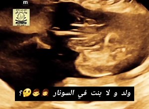 مستشار السونار على TikTok