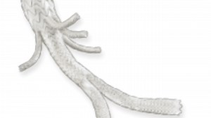 New heart procedure at Bassett Medical Center reduces surgery risks