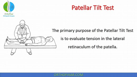 Patellar Tilt Test