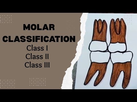 Molar Classification// Molar Class I, II and III