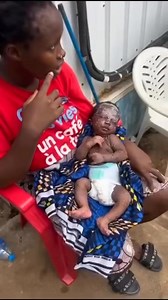 106K views · 931 reactions | Wow! If this young Bby comes in contact with this Mpox, then that means we have no clue yet on how one can come in contact with such virus/disease. Let just stay vigilant and be isolated By the way May God heals the young one and every other person who has come in contact with this . | Mark the blogger | Facebook