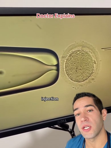 IVF Technique Explained