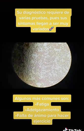 Gusanos en muestras de sangre: ¿qué son y cómo afectan?