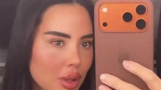 Towie's Yaz Oukhellou shows off the results of her facelift three weeks after op