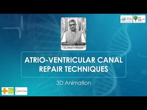 Atrio-ventricular Canal Repair Techniques 3D Animation