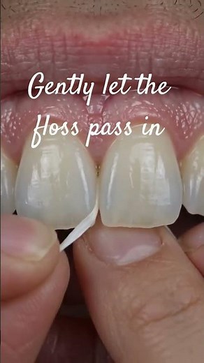 How to Floss your teeth : step by step guide #dentalcare #oralhealthcare