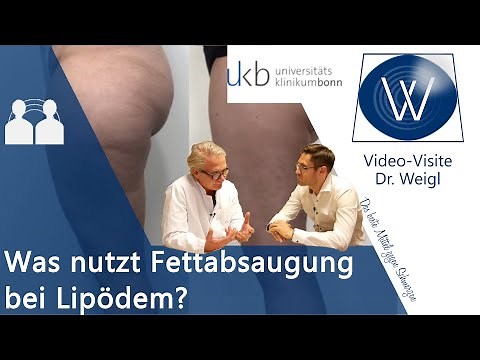 Lipedema & thick legs gone forever through liposuction: Tips & surgical experiences with Dr. Walg...