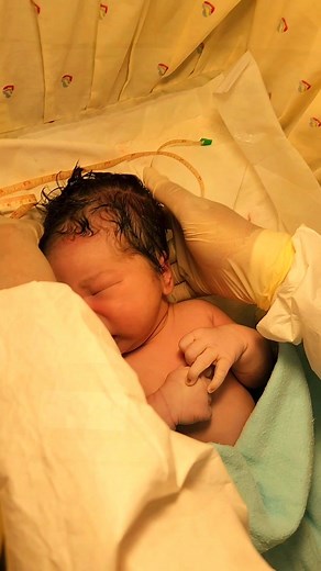 Head circumference #Pregnancy #everyone #babies | MAM NENEN Midwife