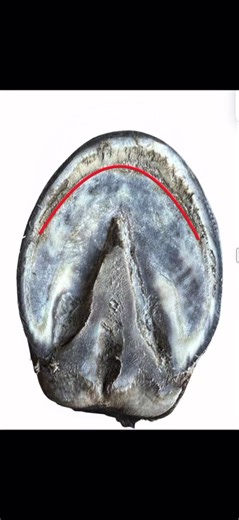 48K views · 392 reactions | It’s not a long toe — it’s a distorted...