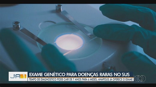 Exame genético para diagnosticar doenças raras é incluído no SUS