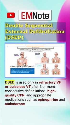 Double Sequential External Defibrillation (DSED) #doctor #medical #ems