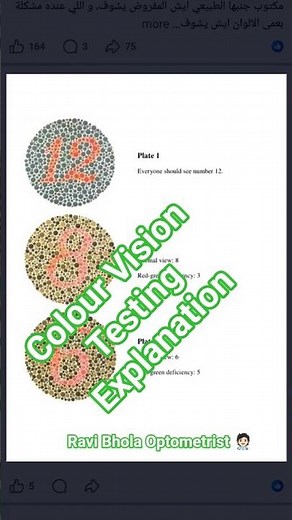 Colour 🧐🧐😇👩🏻‍⚕️ vision Testing Explanation With Ishihara Chart #shorts #shortsfeed #viral #trending