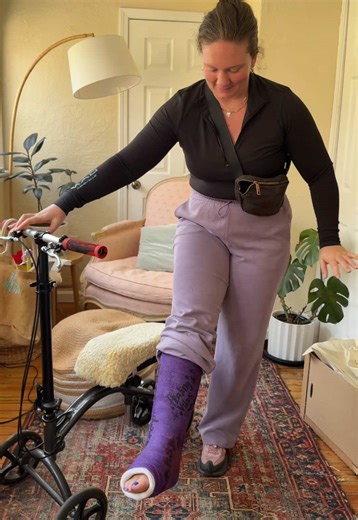 Exciting Cast Removal Day Journey