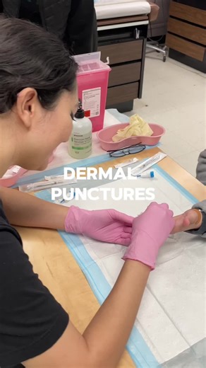 What are dermal punctures? Dermal punctures are a method of collecting blood samples from the surface of the skin, typically using a lancet. Master this skill with us at MHCC! 🩸💉 #HandsOnLearning #MontesHealthCare #RealLifeTraining #MHCCInspires #DreamBigLearnBigger #FutureLeaders #JoinTheMHCCJourney #MedSchoolLife, #FutureDoctor, #MedicalStudents, #MedSchoolJourney, #MedEd, #MHCC #Monteshealthcare #medschool #medstudents #MedicalEducation