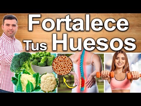 Cómo Endurar Los Huesos Y Mantenerlos Fuertes - Previene La Osteoporosis Y Osteopenia