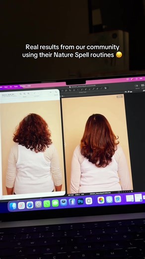 Amazing Hair Growth Results in 6 Months!