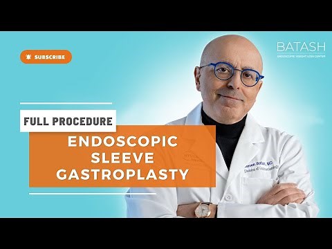 Endoscopic Sleeve Gastroplasty (ESG) Procedure - Full Procedure Video