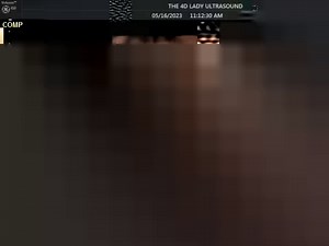 babe needed a quick snack! #18weeks | The 4D Ultrasound Lady