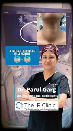 Female Lawyer Chooses Thyroid Nodule Ablation 🎙️⚖️ | Voice Concern Case