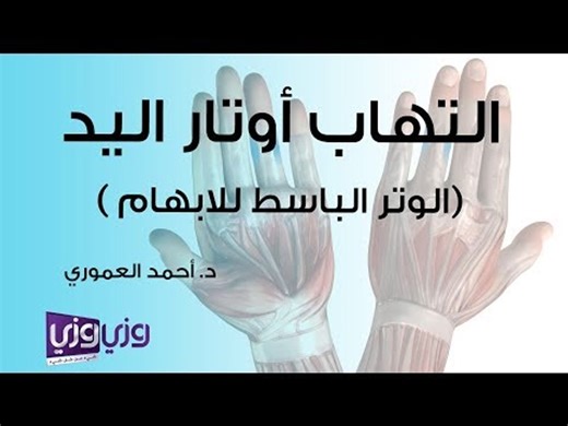 التهاب أوتار اليد (الوتر الباسط للإبهام)