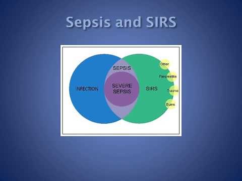 Sepsis pathophysiology-SIRS and CARS