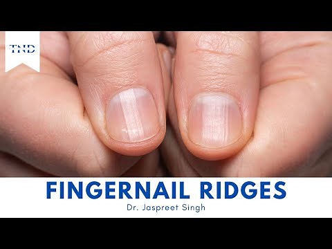Do You Have Vertical Ridges On Your Fingernails? Here's What They Mean!
