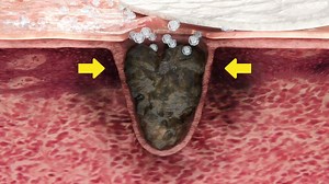 9.6K views · 45 reactions | Residual sebum is the fundamental reason for enlarged pores. Watch how we combined an extract A with a pad to effectively tackle the residual sebum.  Shop now >> https://bit.ly/3b5TFi0 #medicube #ZeroPorePads #PoreCare #Pore_tightening_pad #Daily_care_pads #Daily_exfoliant #SkinEstheticianFave @medicube_global_official | Medicube | Facebook