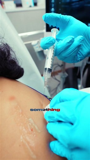 How Deactivating Muscle Knots Stops Severe Neck Pain#TriggerPoint #NeckPain #MuscleKnots