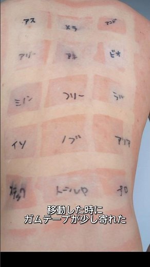 【結果発表】背中を使った日焼け止め実験。