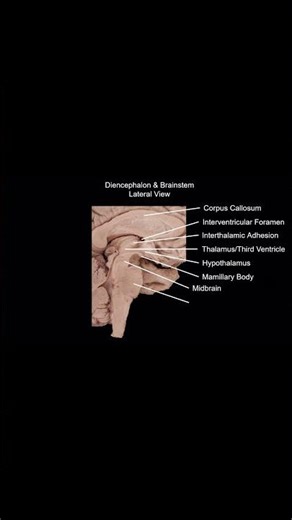 Neuroanatomy: Major landmarks — Diencephalon & Brainstem #anatomy #brain #medical #medicalstudents
