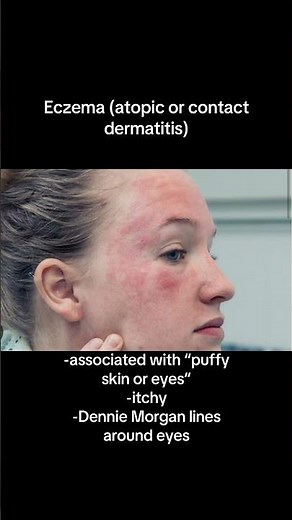 What’s causing your dry skin from a dermatologist. #dryskin #dermatologist